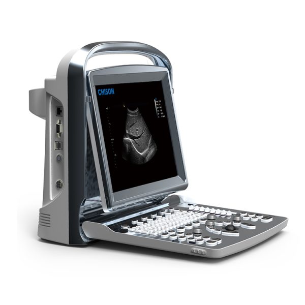 Musculoskeletal ultrasound course : sonografia obstetrica chison eco 2