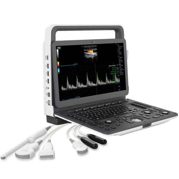 Nuevo Llegada Comparable Escáner de Ultrasonido Sonoscape E2 M20 / Máquina de Ultrasonido Médico Con Sonda Convexa