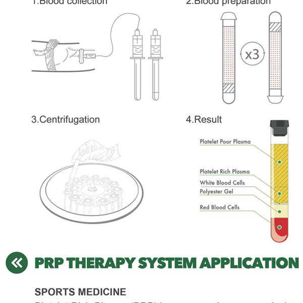 Kit Prp Médico Corea 8 ml/ 10 ml/ 12 ml/ 15 ml/ Tubo Prp de Gel Separador de Citrato de Sodio B.S.D.PRP03