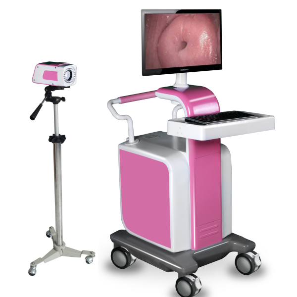Precio de la cámara colposcópica de video médica para vagina con software