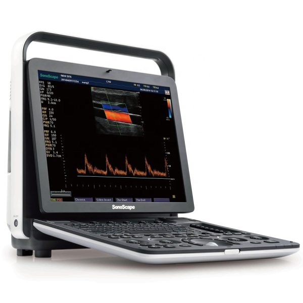 Precio de la máquina de ultrasonido Doppler a color portátil Sonoscape S9 / S9pro 3D 4D