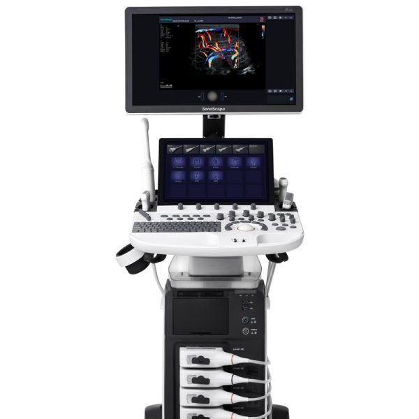 Sistema de diagnóstico ultrasónico médico de instrumento de ultrasonido SonoScape P50 Elite AI Máquina de ecocardiografía Máquina de eco.