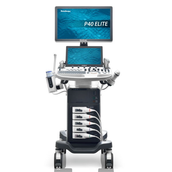 Sistema de diagnóstico ultrasonográfico médico SonoScape P40 Elite AI Máquina de ecocardiografía de sistema de diagnóstico ultrasonográfico médico Echo Machine