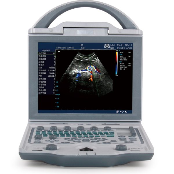 Sistema de diagnóstico veterinario portátil médico en color Doppler Vet Color Ultrasound MSLCU23V