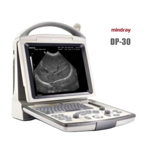 Sistema de ultrasonido B/N digital completo Mindray DP-30 con escáner de diagnóstico