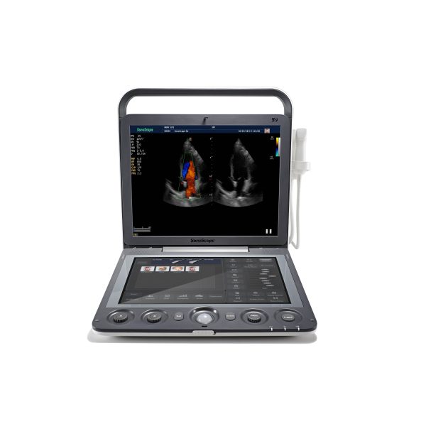 Sistema de ultrasonido portátil a color Doppler de alta densidad Sonoscape S9V con sonda de alta calidad para veterinaria.