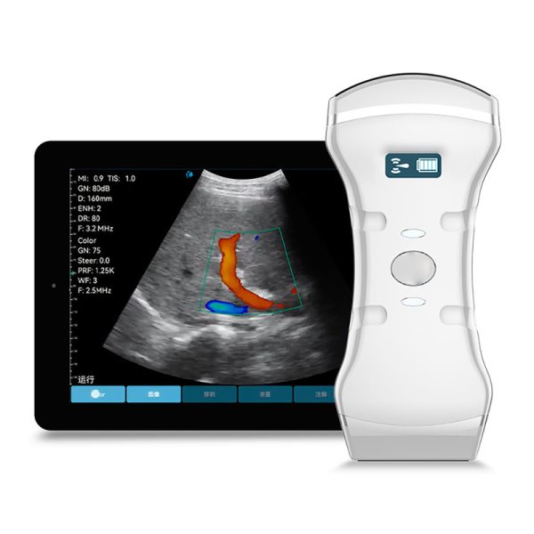 Sonda de ultrasonido Doppler en color inalámbrica Sonda convexa y lineal MSLMY10P