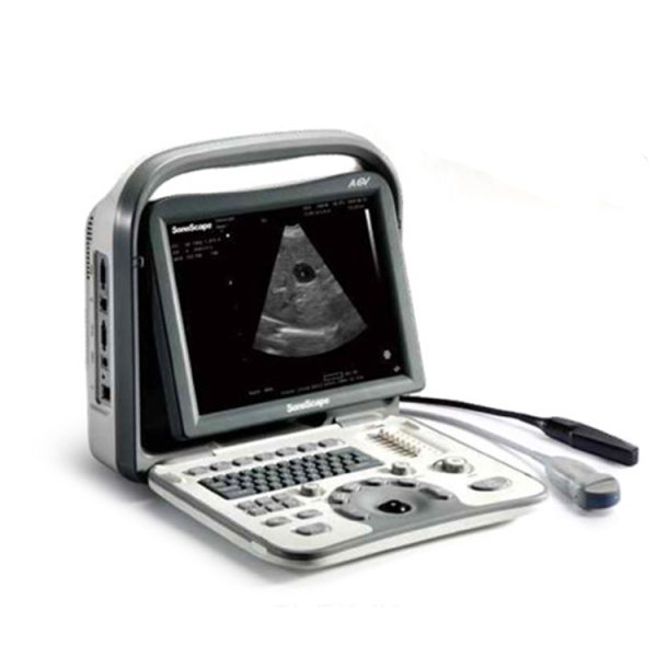 SonoScape A6v veterinary ultrasound : ultrasonido obstetrico SonoScape A6v