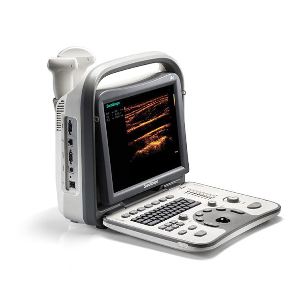 Sonoscape ultrasound sonoscape a6 price: ultrasound machine