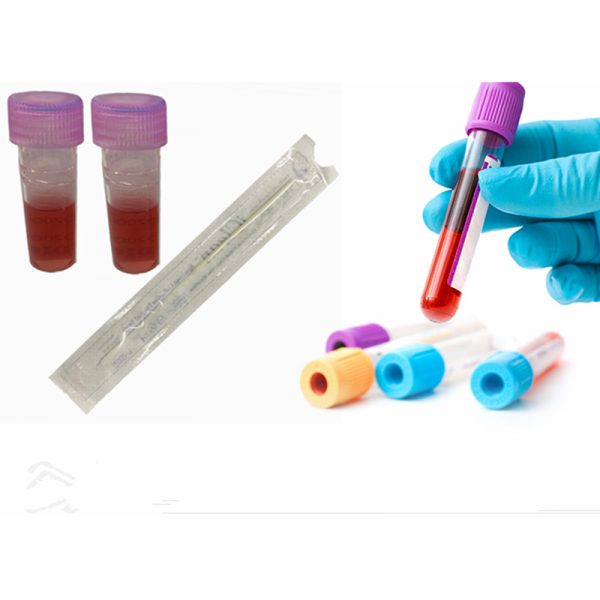 Tubo de recolección de muestras de hisopo de garganta oral nasal estéril desechable de nylon para pruebas de laboratorio MSLVTS10