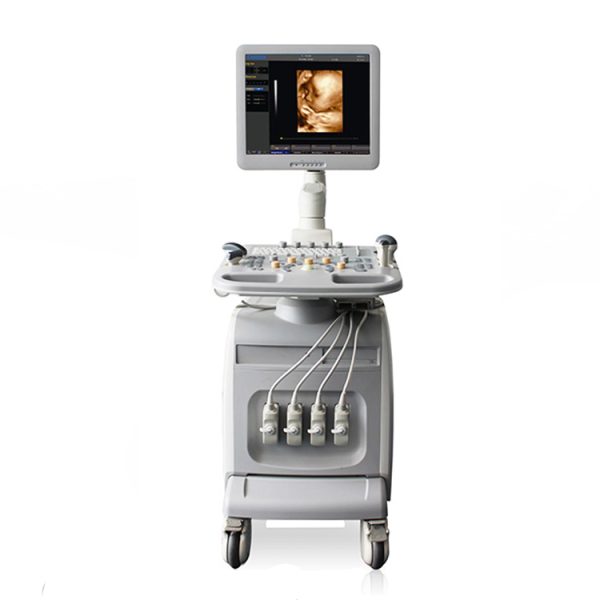 ecografía doppler obstétrica 4d : ecografía abdominal chison i3
