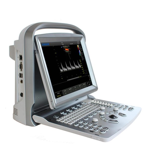 Ultrasonido (ecografo) abdominal con Doppler  : chison eco 5 approved FDA Chison eco 5