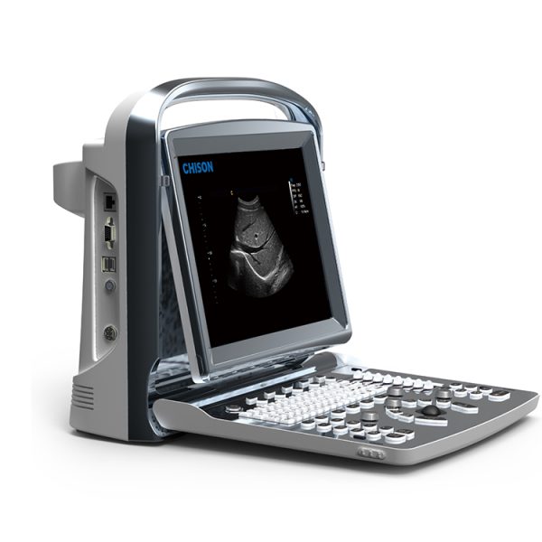 Ultrasonido (ecografo) abdominal imaging : chison eco 1 approved FDA Chison ECO 1