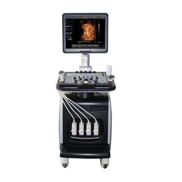 Ultrasonido abdominal Chison i8: ultrasonido 4D Doppler obstétrico