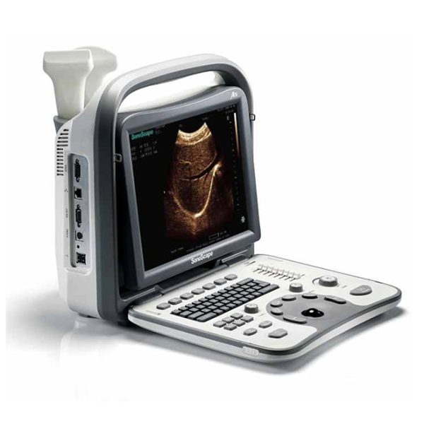 ultrasonido portatil sonoscape a5 price list : ultrasonido abdominal