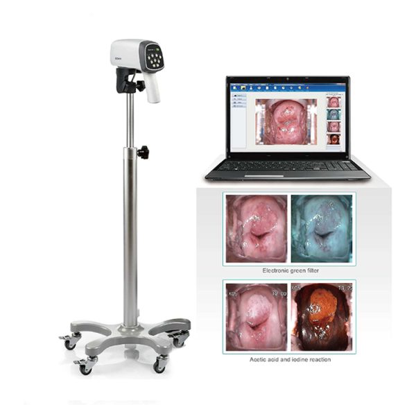 Video de ginecología precio colposcopio vagina C3A