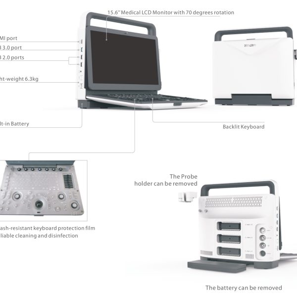 B.S.D. M70 – Ultrasonido Doppler Color Portátil