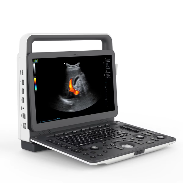 ECÓGRAFO LAPTOP 3D/4D - Ultrasonido Doppler Color Portátil B.S.D. CU77M30