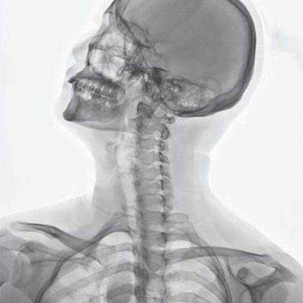 Película seca Modelo: