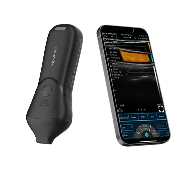Sonda de ultrasonido lineal alta C10MR Pro USB & Wifi