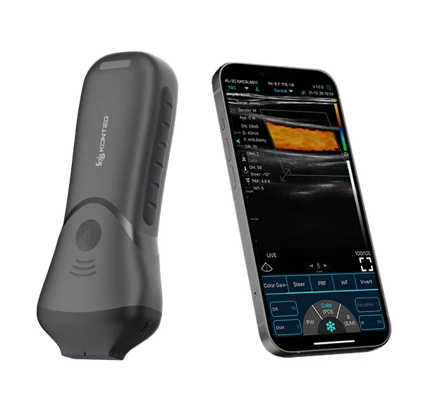 Sonda de ultrasonido lineal de alta frecuencia C10MS USB & Wifi