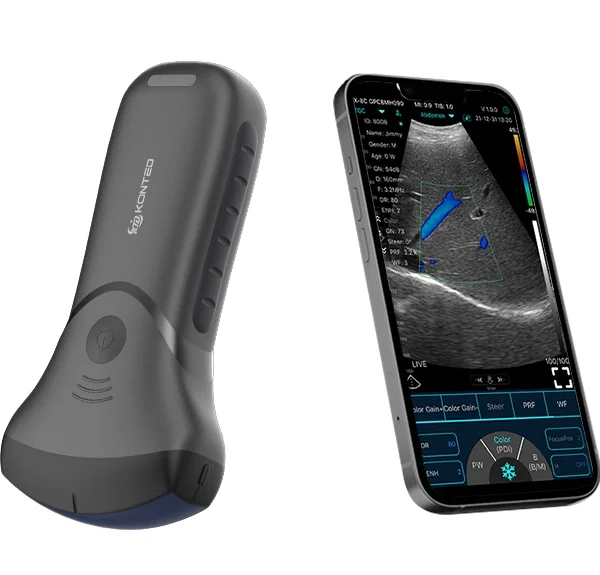 C10MT USB & Wifi Sonda de ultrasonido convexo