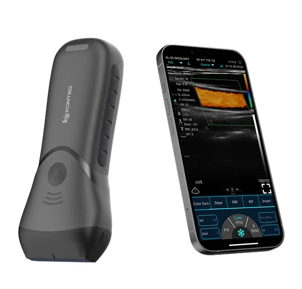 C10MX Color Superficial Ultrasonido HD Sonda Lineal