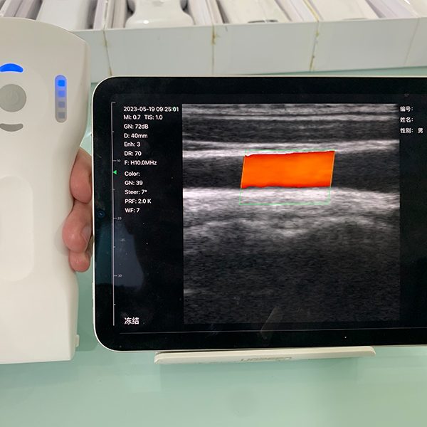 B.S.D. 8CL – Ecógrafo inalámbrico 3-en-1 (192 elementos / 64 canales)