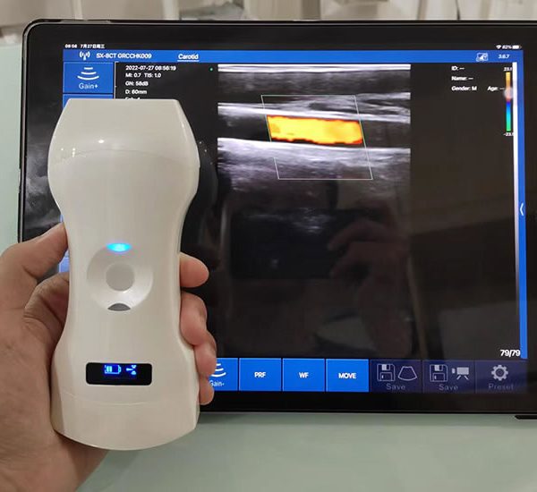B.S.D. 6CL – Ecógrafo inalámbrico palm Doppler 3-in-1 (192 elementos / modular)